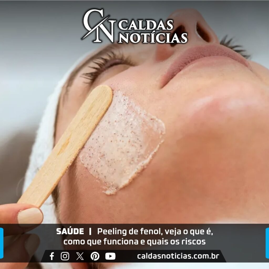 Peeling de fenol